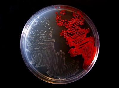 A culture plate from a UW-Stout biotechnology lab shows, at left, the colorless bacterium Serratia marcescens strain sicaria discovered by university researchers. At right, for comparison, is another type of bacteria.