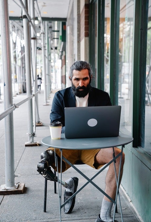 person with prosthetic leg sitting at a desk with a laptop open